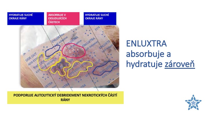 Enluxtra návod9